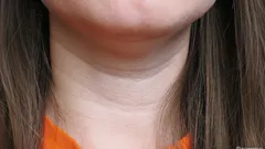 Odmah otkriva tvoju dob: kako se riješiti bora na vratu